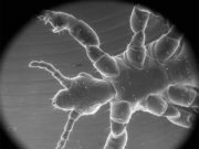 Científicos argentinos desarrollan nanocápsulas efectivas contra los piojos