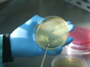 El INTA desarrolló una vacuna contra la Escherichia coli en bovinos